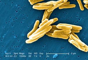 Tuberkulose-Erreger (vergörßert durch ein Mikroskop)