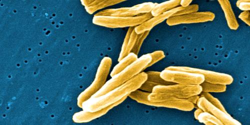 Tuberkulose-Erreger (vergörßert durch ein Mikroskop)