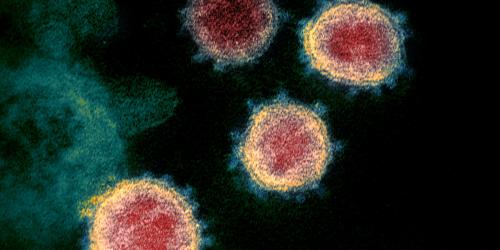 Mehrere relativ runde Flächen mit roten Kern und gelbem Rand auf einem dunklen Hintergrund - das Coronavirus unter dem Mikroskop betrachtet