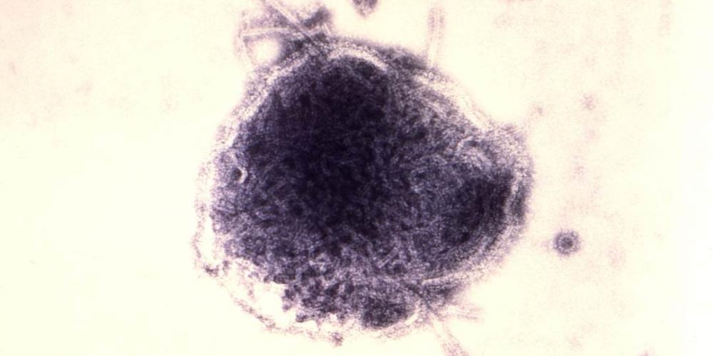 Ein violett eingefärbtes Masernvirus in vergrößerter Darstellung
