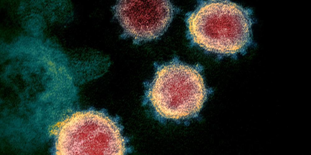 Mehrere relativ runde Flächen mit roten Kern und gelbem Rand auf einem dunklen Hintergrund - das Coronavirus unter dem Mikroskop betrachtet