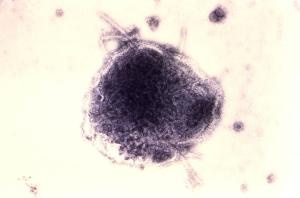 Ein violett eingefärbtes Masernvirus in vergrößerter Darstellung