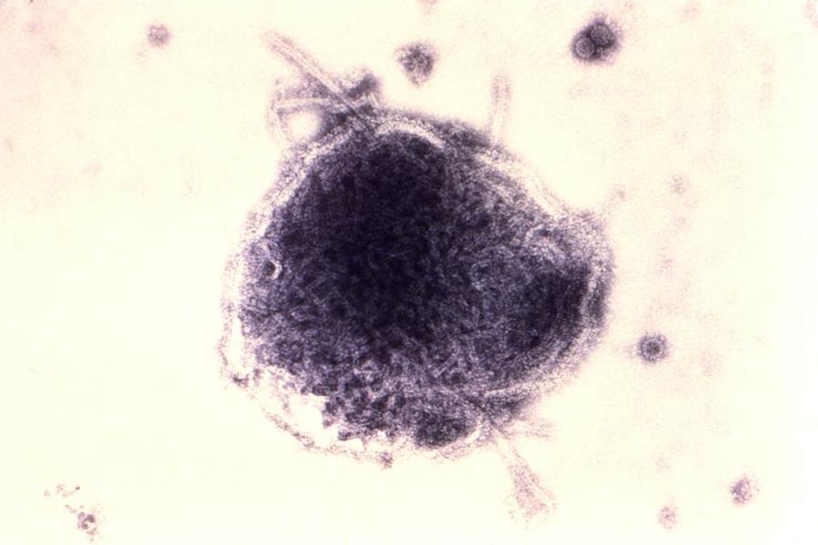 Ein violett eingefärbtes Masernvirus in vergrößerter Darstellung