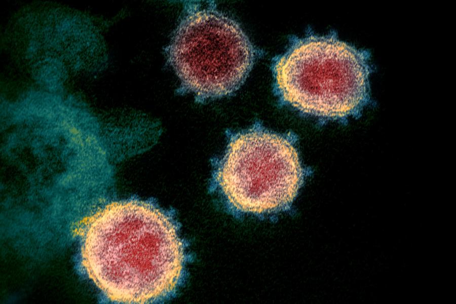 Mehrere relativ runde Flächen mit roten Kern und gelbem Rand auf einem dunklen Hintergrund - das Coronavirus unter dem Mikroskop betrachtet