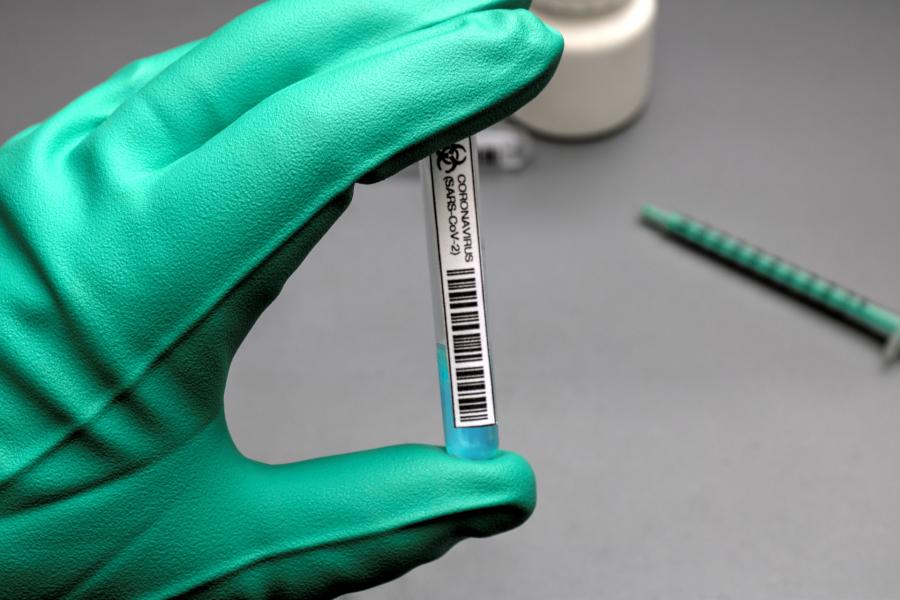 Eine Hand hält ein Teströhrchen